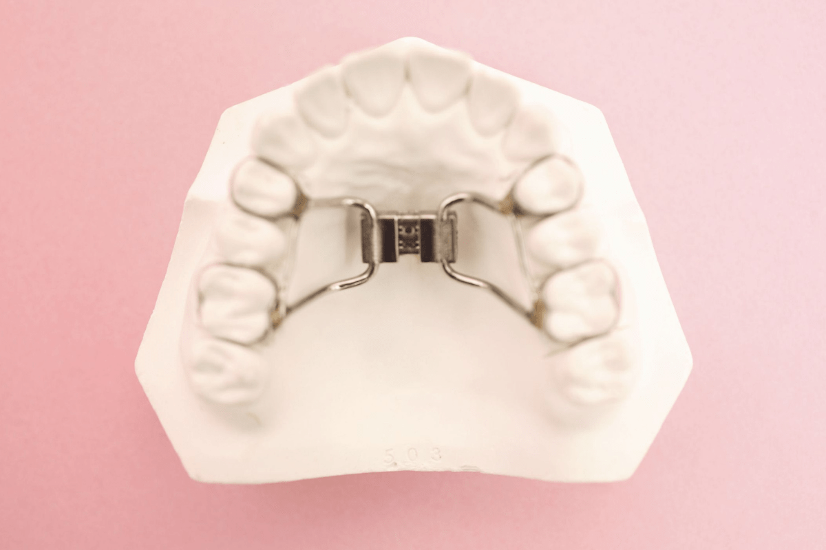 Palatal Expander